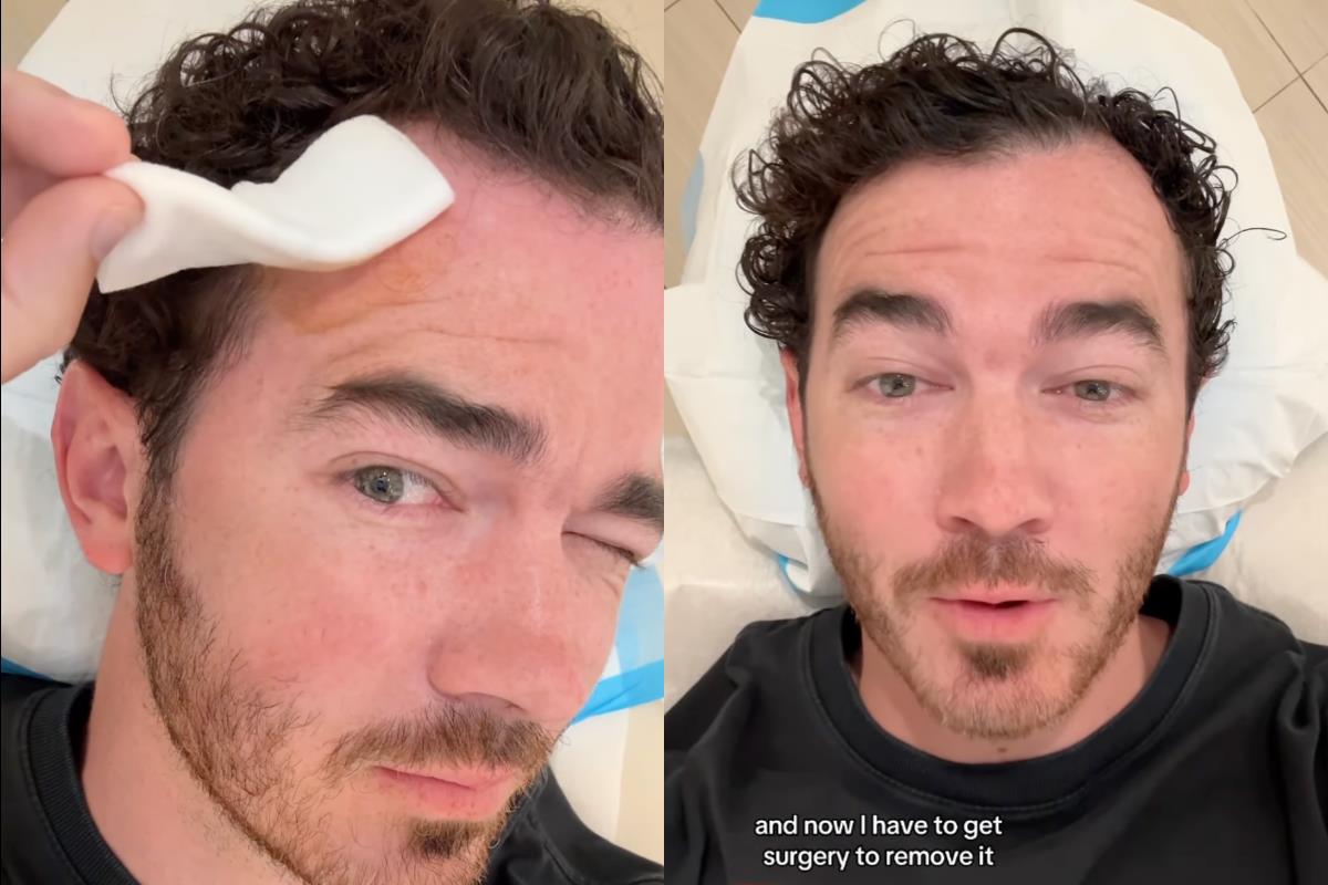 Kevin Jonas anuncia cáncer de piel. Foto: IG kevinjonas