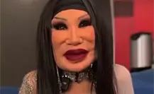 Lyn May sorprende a todos por el tamaño de su rostro, ¿Qué le pasó? Lyn May sorprende a todos por el tamaño de su rostro, ¿Qué le pasó?