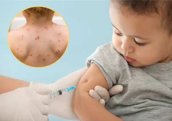 Sin vacunas contra varicela en Piedras Negras