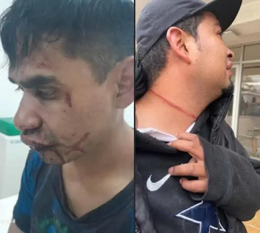 Servidores públicos de Otumba golpearon a dos jóvenes; uno está en el hospital