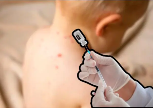 Vacuna contra el sarampión en BCS: dónde acudir para protegerte tras casos recientes