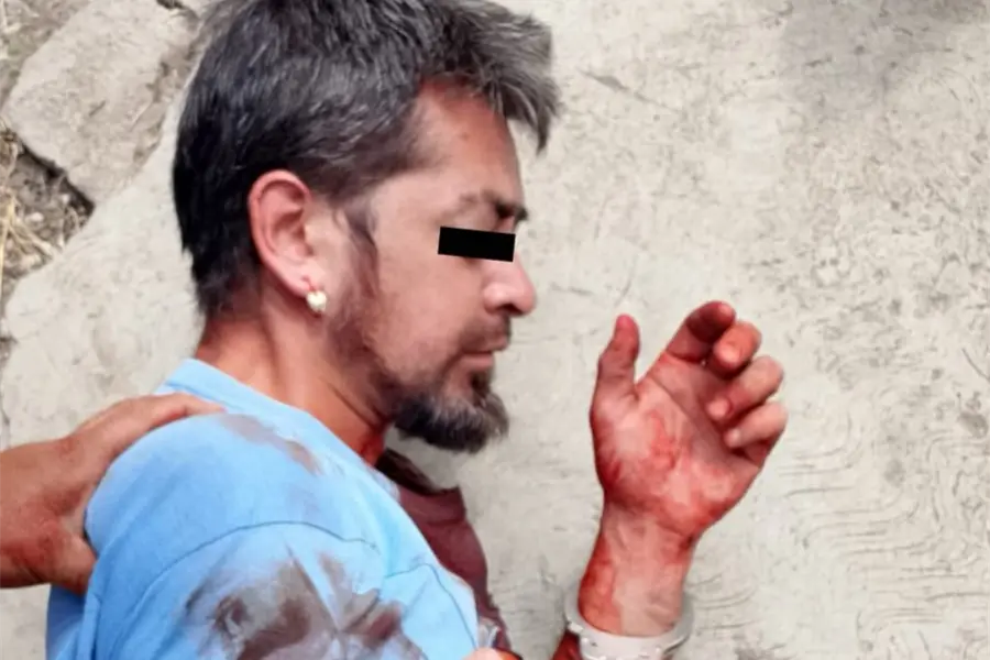 Ataca a su familia con un cuchillo en Ecatepec; estaba drogado y ebrio