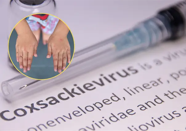 Manos, pies y boca: el virus que causa suspensión de clases en Baja California