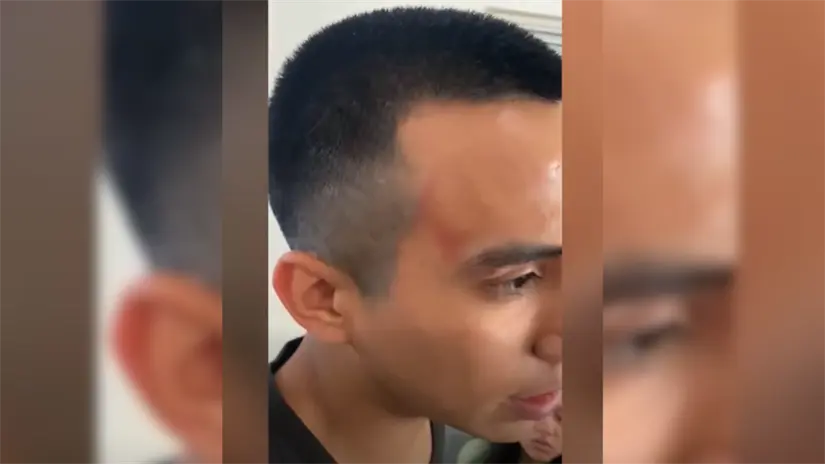 imagen recuadro Foto: El Mangle / Facebook.