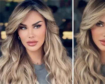Ninel Conde cambia el color de sus ojos ¿en qué consiste la cirugía y cuáles son sus riesgos?