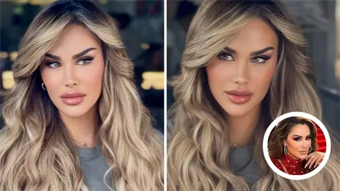 Ninel Conde cambia el color de sus ojos ¿en qué consiste la cirugía y cuáles son sus riesgos? Ninel Conde cambia el color de sus ojos ¿en qué consiste la cirugía y cuáles son sus riesgos?