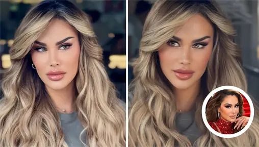 Ninel Conde cambia el color de sus ojos ¿en qué consiste la cirugía y cuáles son sus riesgos? Ninel Conde cambia el color de sus ojos ¿en qué consiste la cirugía y cuáles son sus riesgos?