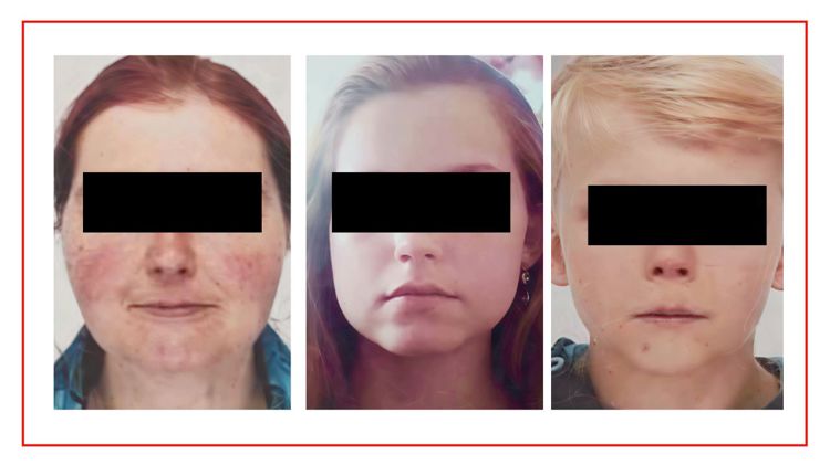 imagen-cuerpo imagen-cuerpo