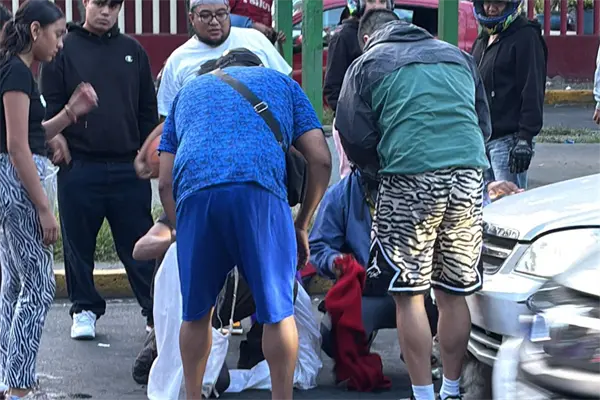 Conductor atropella a perro callejero y huye en Anillo Periférico Conductor atropella a perro callejero y huye en Anillo Periférico