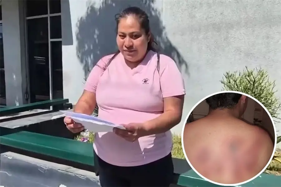 Estudiante en secundaria de Tijuana es atacado con sosa cáustica por sus compañeros